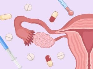 OHSS-Symptome nach der Eizellentnahme: Was Sie wissen sollten