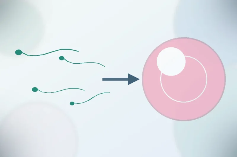 Hem Yumurta Hem Sperm Sorunu Varsa Ne Yapılır?